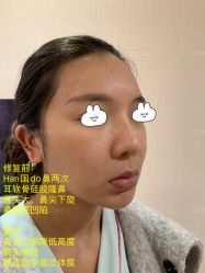 -北京米扬丽格医疗美容·联合丽格鼻整形中心