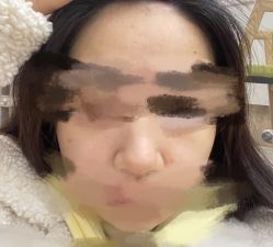 -正璞医疗美容·皮肤修复·微整注射