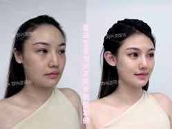 -Yestar重庆艺星医疗美容医院