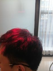 -雍禾植发