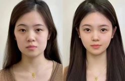 -Yestar 嘉兴艺星医疗美容医院