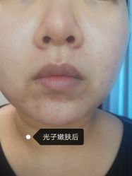 -小忠丽格医美