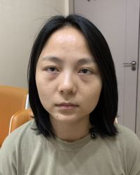 -广州健丽·去眼袋医疗美容机构