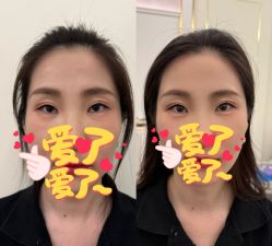 -U3美甲