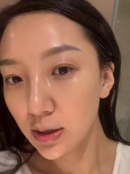 体验后-石家庄苏亚美联臣医疗美容医院