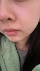 -长沙雅美医疗美容医院