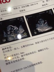 -上海百佳母婴护理中心