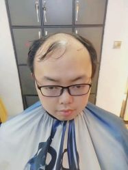 -发饰美男士增发补发假发定制店