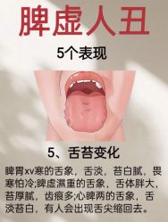 -克丽缇娜