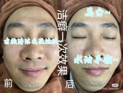 -安吉拉青春化管理中心