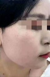 -北京美痣堂古方祛痣斑疣瘊