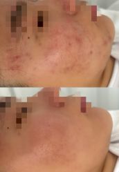 -康美贞·痘肌养护管理中心