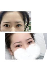 点击看大图 -Verywang半永久纹眉•仪器野生眉