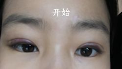 -哈尔滨瑞丽医疗美容医院