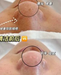 -Cream88颜皮肤管理中心