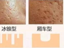 -苗方清颜痘肌研究所