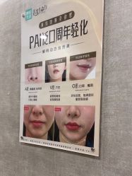 -深圳鹏爱秀琪医疗美容医院
