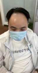 -靓康增发补发假发