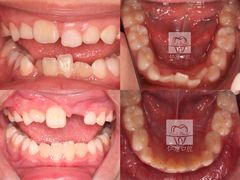 -Dr.Z dental仁康种植矫正中心
