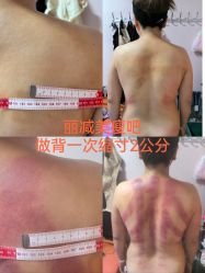-丽减美瘦吧·减肥瘦身