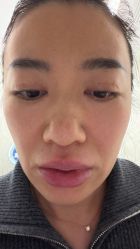 点击看大图 -欧扬医疗美容