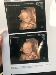 -重庆安琪儿妇产医院-妇幼保健联盟医院