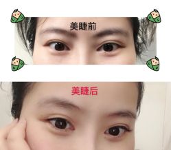 -初樱科技美学问题肌修复中心
