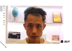 -大麦微针植发全国连锁