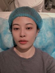 点击看大图 体验前-华臣医疗美容