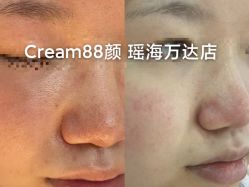 -Cream88颜皮肤管理中心