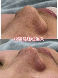 -SKIN79皮肤管理中心