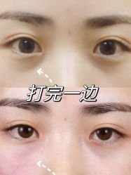 -Yestar重庆艺星医疗美容医院