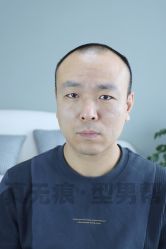 -型男帮男士假发补发·佩戴式发型