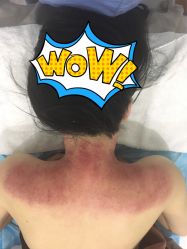-紫御国际抗衰ZOE ANTI AGING