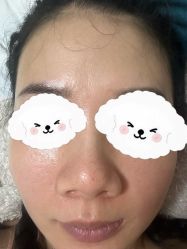 体验前-上海玫瑰医疗美容医院