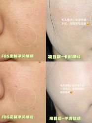 -凡碧诗毛孔清洁收细