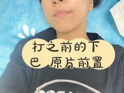 -联合丽格·张菡丽格医疗美容