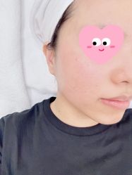 体验后-恒妍医美·韩国定制抗衰中心