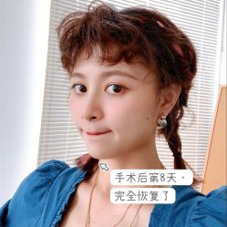 -天津健丽·去眼袋医疗美容机构
