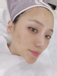 -苗方清颜·祛痘皮肤管理