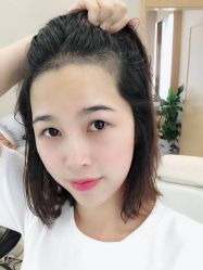 -大麦微针植发丨全国连锁