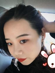 点击看大图 -大麦微针植发丨全国连锁