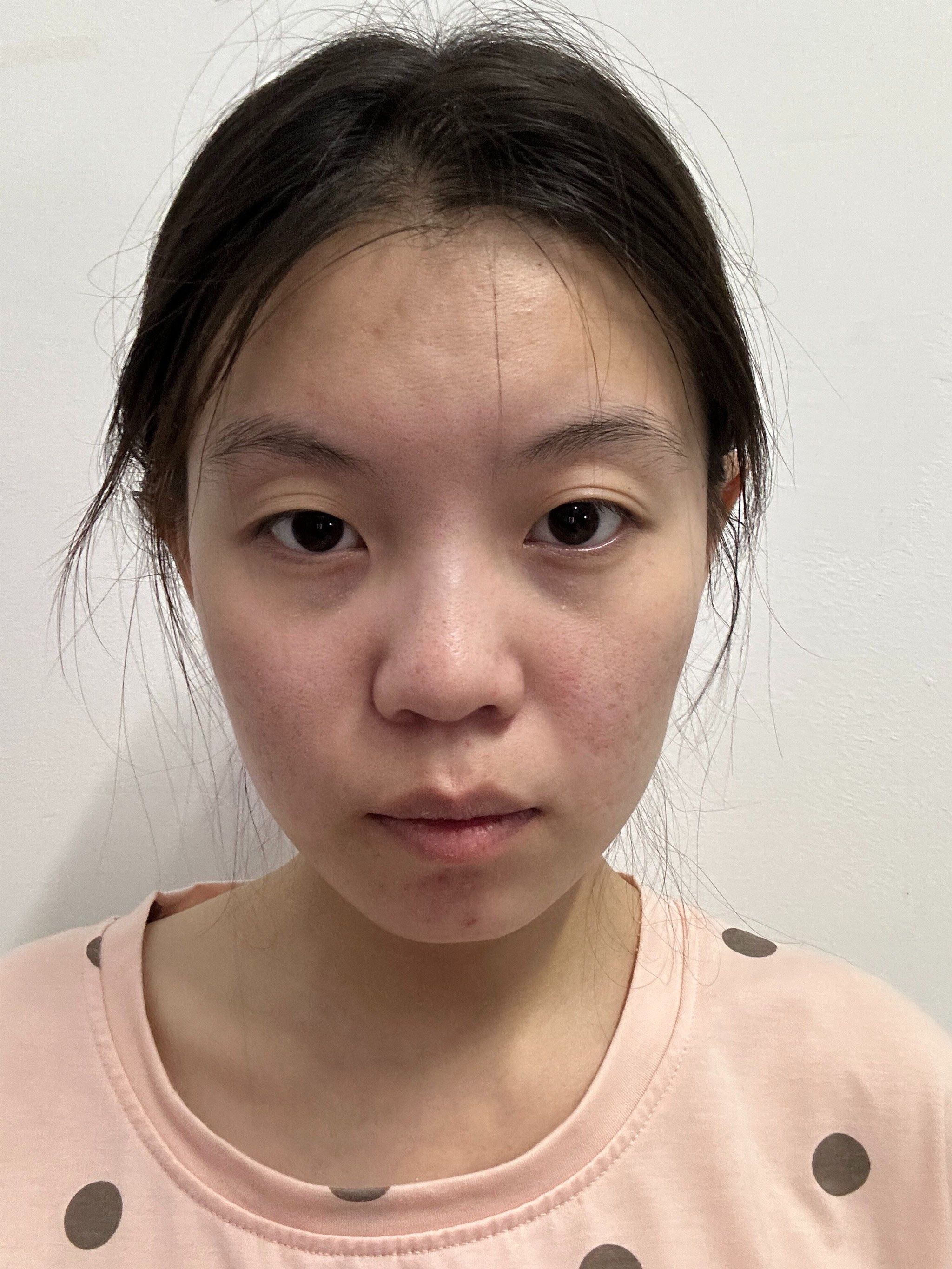 两侧脸不对称
整个面部的轮廓看起来平整度不高

自己摸索钻研