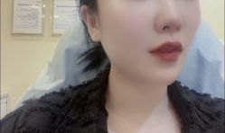 体验后-上海首尔丽格医疗美容医院