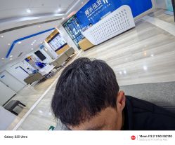 体验后-雍禾植发全国连锁