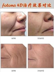 -北京米扬丽格医疗美容·联合丽格鼻整形中心