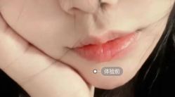 体验前-杭州米兰柏羽医疗美容医院