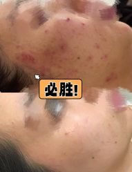 -LUNA皮相美·骨相美高级美感