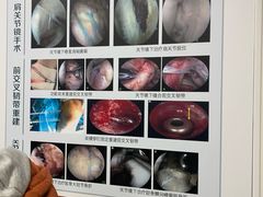 -中国人民解放军总医院