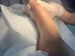 -世龙世家灰指甲鸡眼脚气甲沟炎跖疣护理(通州店)